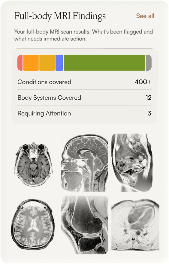 Full-body MRI findings in the CoreVitals app