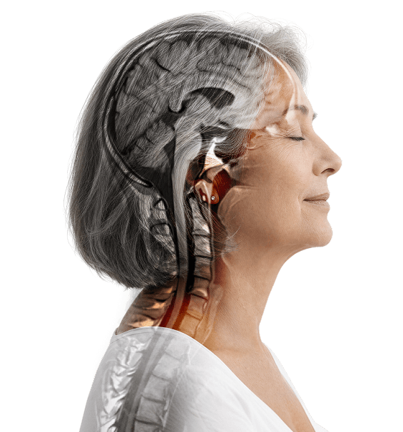 A woman in profile with an MRI image of her head and spine overlaid