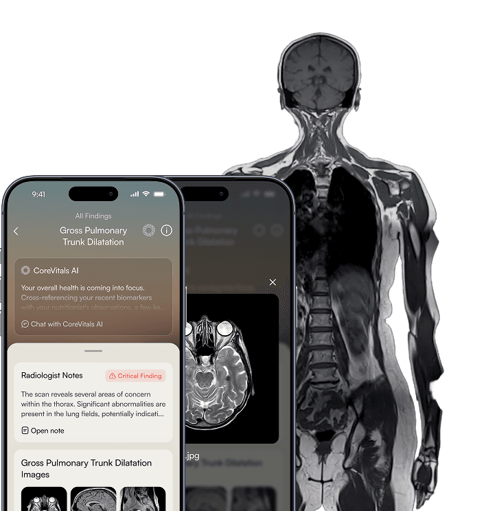 An MRI of the full body beside phones showing radiologist notes and scan images