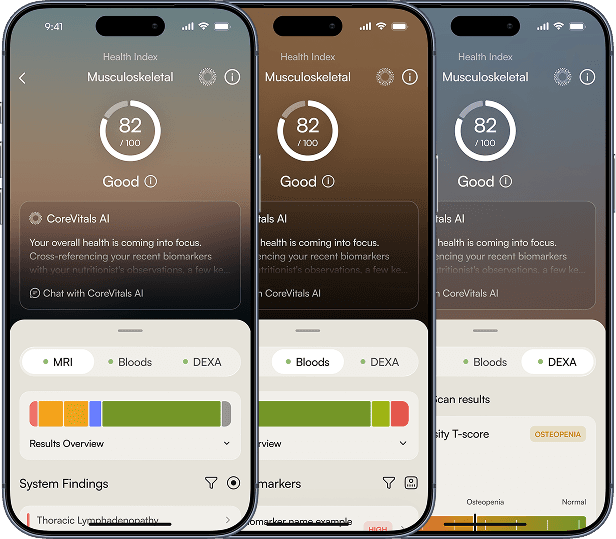 The CoreVitals app showing a musculoskeletal score drawn from MRI, blood and DEXA results