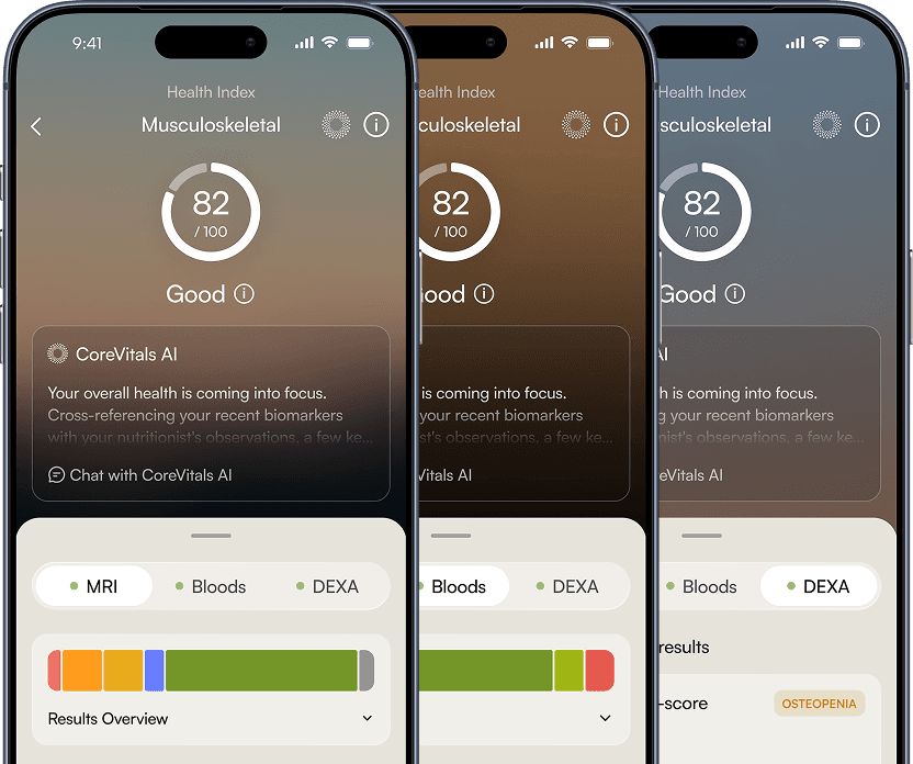 The CoreVitals app showing a musculoskeletal score drawn from MRI, blood and DEXA results